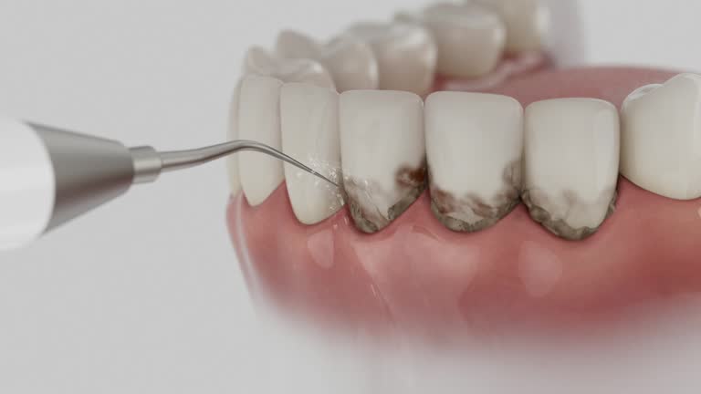 Reliable Dental contractor in Mount Sterling, OH by Dentist Open Now